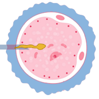 ICSI/IMSI