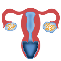 Ovulation Induction